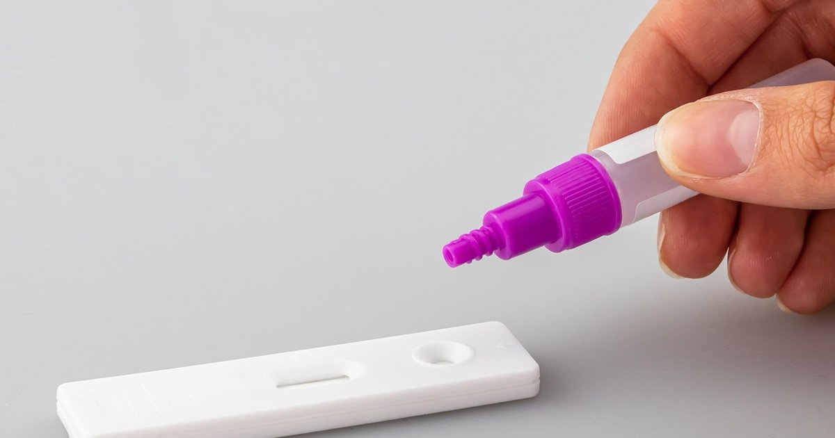 sysbench - System-Benchmarks durchführen